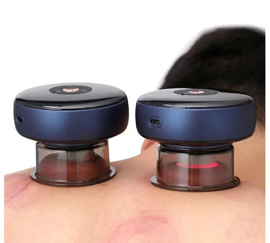 Electric Vacuum Cupping Massager - Urban Muse